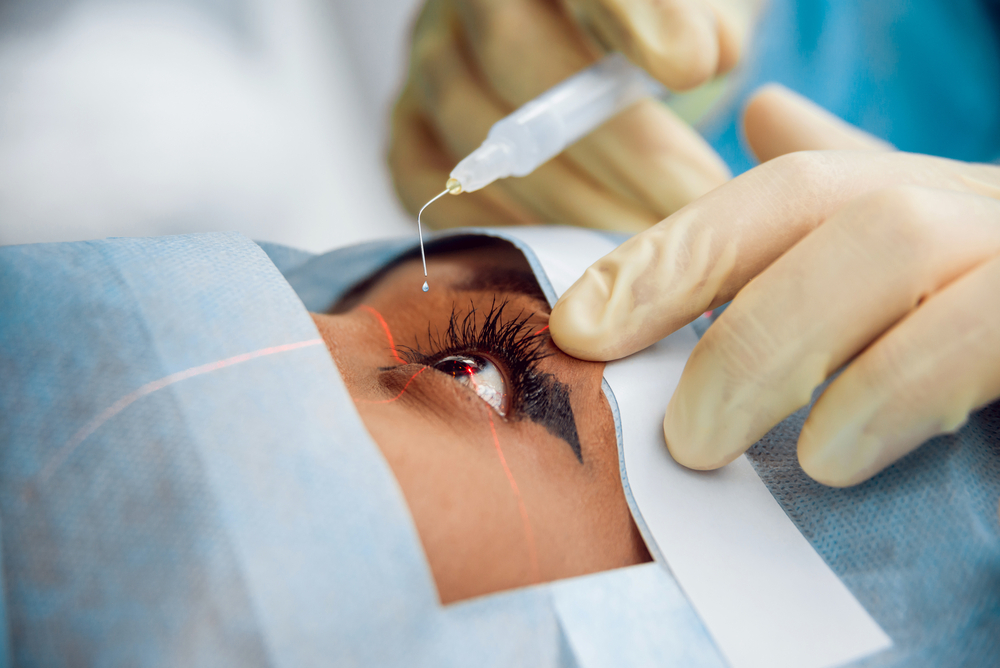 A doctor from The Cataract Surgeons approaches a patients eye prepped for a cataract surgery