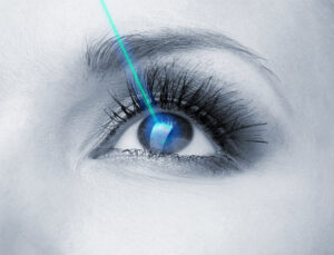 The Cataract Surgeons performing laser eye surgery in Shreveport, LA