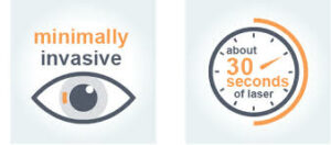 Minimally invasive SMILE eye surgery infographic