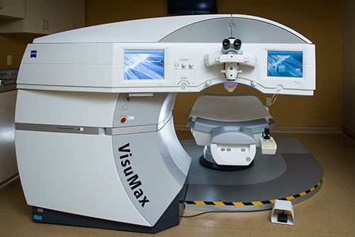 SMILE Eye Surgery Shreveport SMILE Eye Surgery Technology